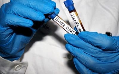 There’s a clear takeaway from the hantavirus and Ebola outbreaks
